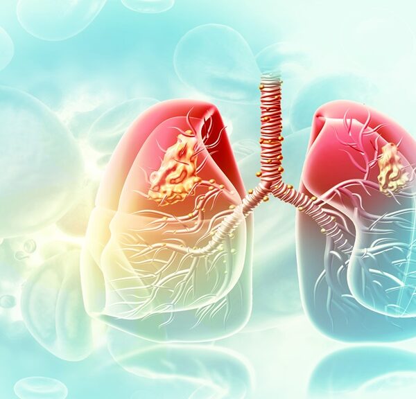 Are Asthma Symptoms Easy to Diagnose