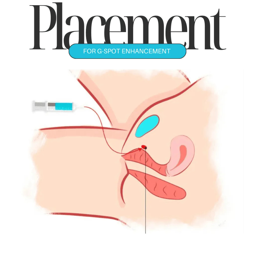 G-spot Enhancement in Dubai