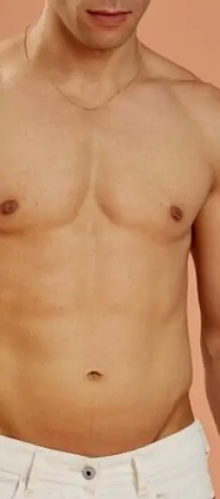 شفط الدهون في جدة لنحت الجسم واستعادة التناسق