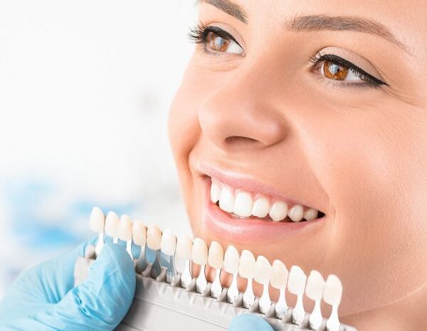 Cosmetic Dental Treatments Dubai